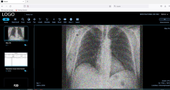 DICOM WebViewer